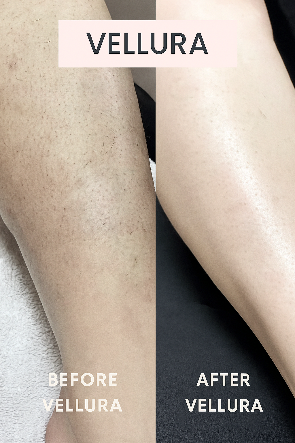 Vellura Smooth Trimmer